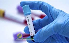 الصحة الايرانية: تسجيل ۷۴ حالة وفاة جديدة بفيروس كورونا في البلاد واجمالي الوفيات يصل الى ۶۲۷۷